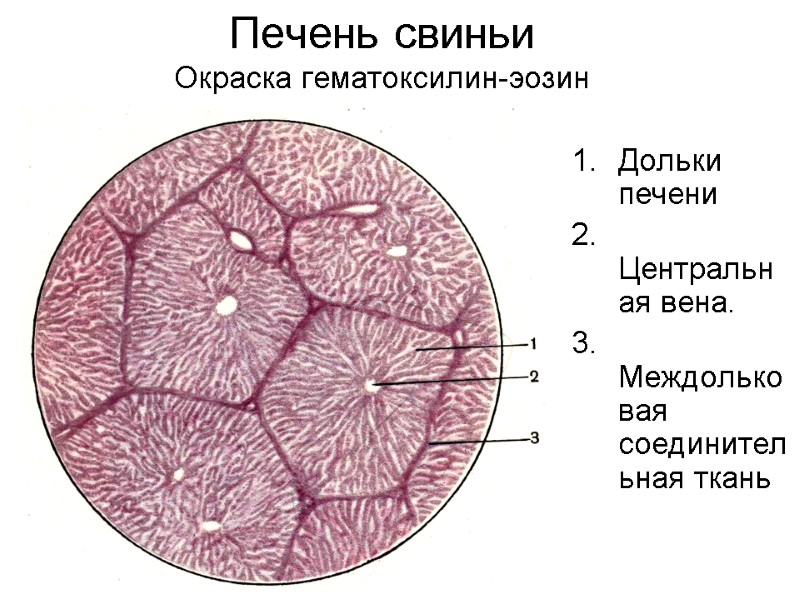 Печень свиньи Окраска гематоксилин-эозин Дольки печени 2. Центральная вена. 3. Междольковая соединительная ткань